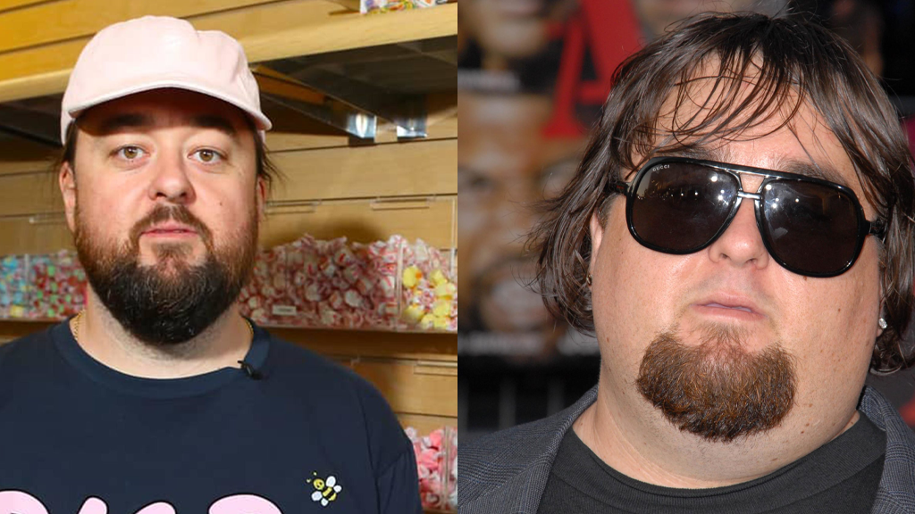 After Undergoing 160 Pound Weight Loss Chumlee From ‘pawn Stars Looks