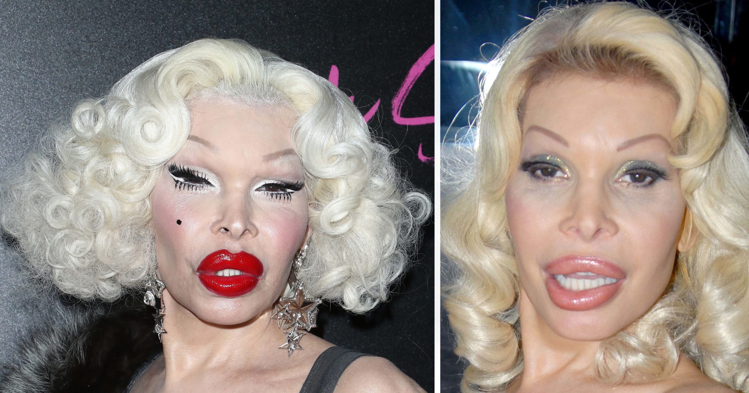 Amanda Lepore is popularly known for her numerous surgeries. 