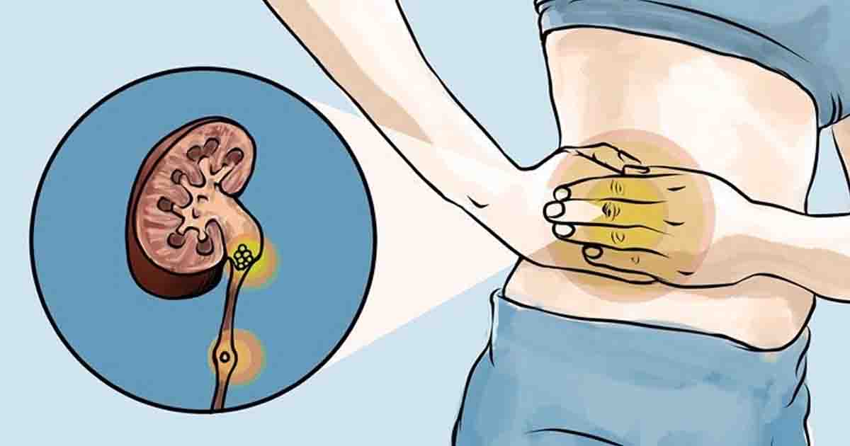 Avoid Ignoring These 9 Symptoms of a Toxic Kidney